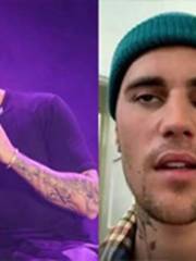 Justin Bieber Gets Facial Paralysis Justin Bieber Gets Facial Paralysis